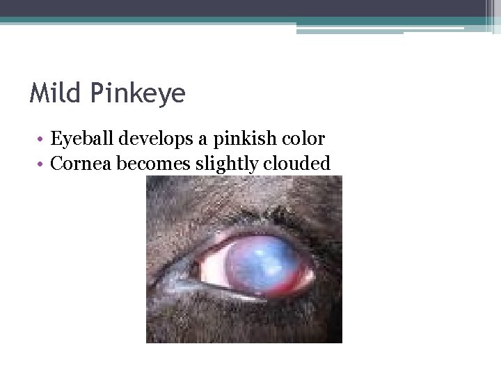 Mild Pinkeye • Eyeball develops a pinkish color • Cornea becomes slightly clouded 