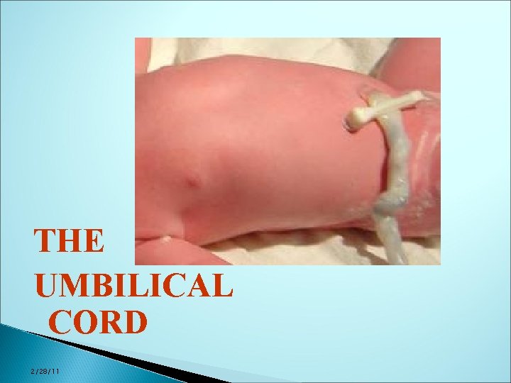 THE UMBILICAL CORD 2/28/11 