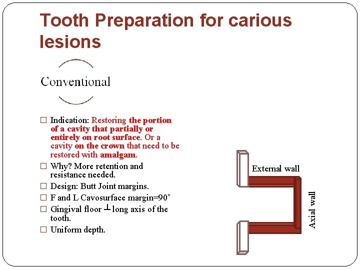 Tooth Preparation for carious lesions � Indication: Restoring the portion � � External wall