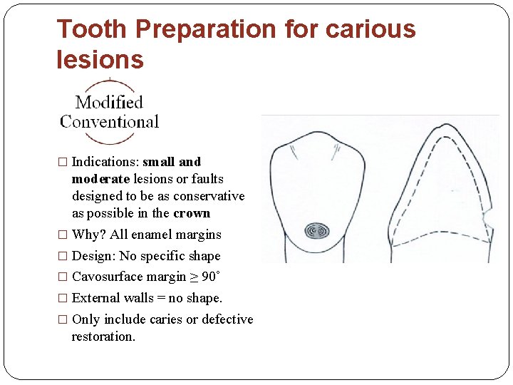 Tooth Preparation for carious lesions � Indications: small and moderate lesions or faults designed