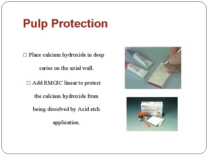 Pulp Protection � Place calcium hydroxide in deep caries on the axial wall. �