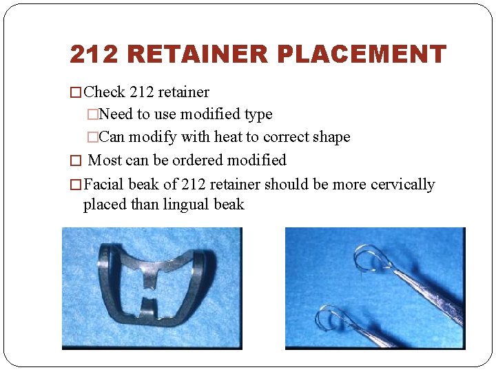 212 RETAINER PLACEMENT � Check 212 retainer �Need to use modified type �Can modify