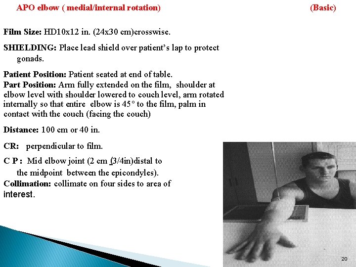 APO elbow ( medial/internal rotation) (Basic) Film Size: HD 10 x 12 in. (24