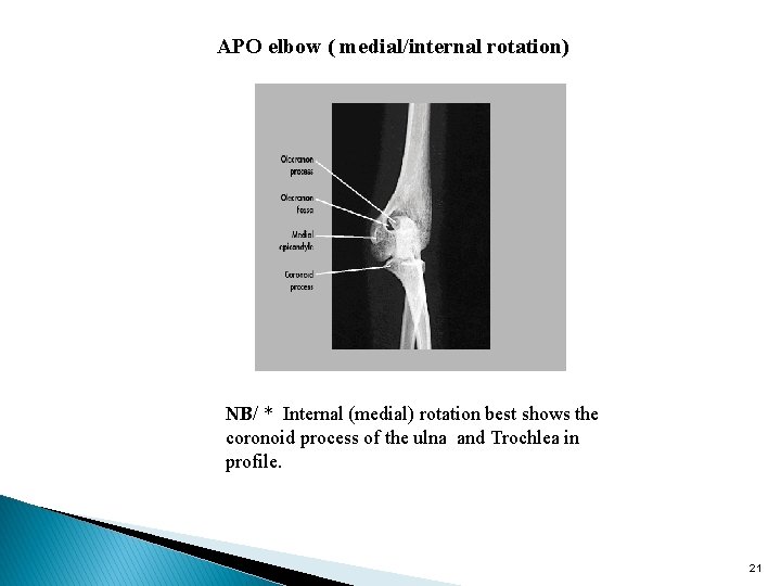 APO elbow ( medial/internal rotation) NB/ * Internal (medial) rotation best shows the coronoid