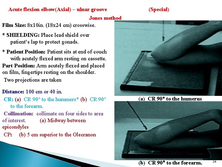 Acute flexion elbow(Axial) – ulnar groove (Special) Jones method Film Size: 8 x 10