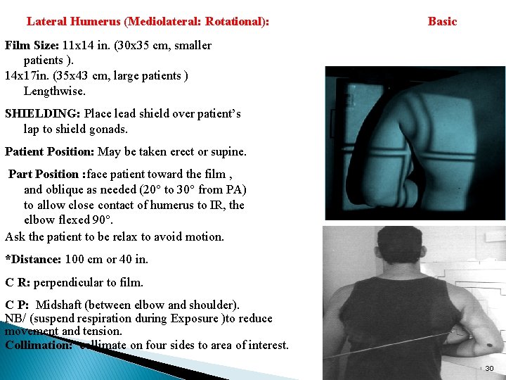 Lateral Humerus (Mediolateral: Rotational): Basic Film Size: 11 x 14 in. (30 x 35