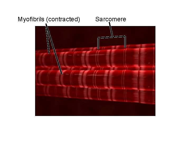Myofibrils (contracted) Sarcomere 
