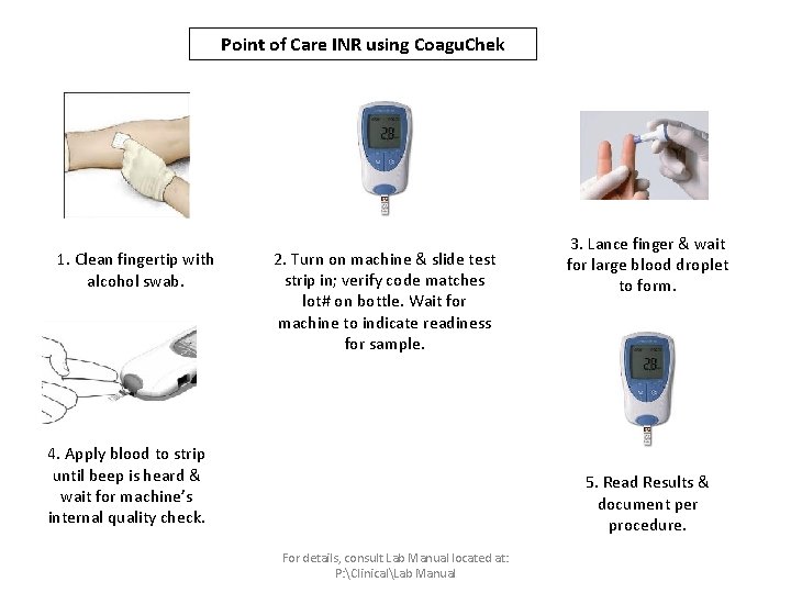 Point of Care INR using Coagu. Chek 1. Clean fingertip with alcohol swab. 2.