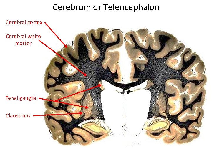 Cerebrum or Telencephalon Cerebral cortex Cerebral white matter Basal ganglia Claustrum 