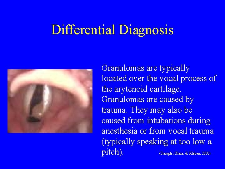 Differential Diagnosis Granulomas are typically located over the vocal process of the arytenoid cartilage.