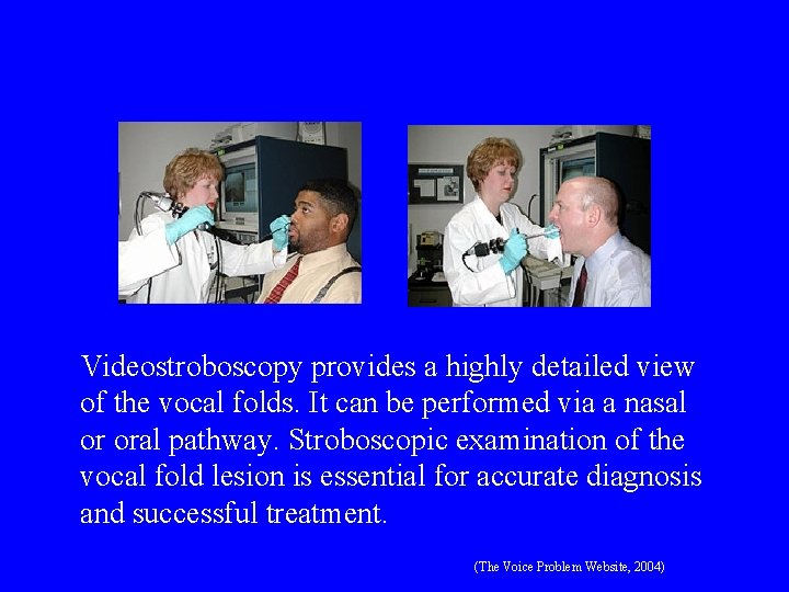 Videostroboscopy provides a highly detailed view of the vocal folds. It can be performed