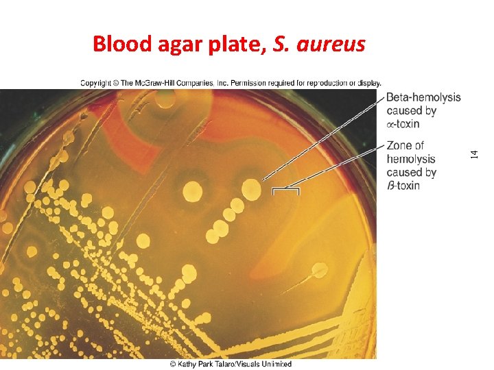 14 Blood agar plate, S. aureus Dr. T. V. Rao MD 