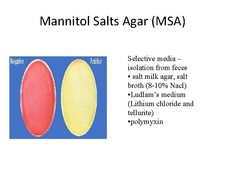 Mannitol Salts Agar (MSA) Selective media – isolation from feces • salt milk agar,