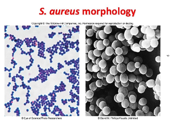 6 S. aureus morphology 