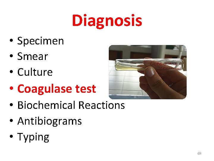 Diagnosis • Specimen • Smear • Culture • Coagulase test • Biochemical Reactions •
