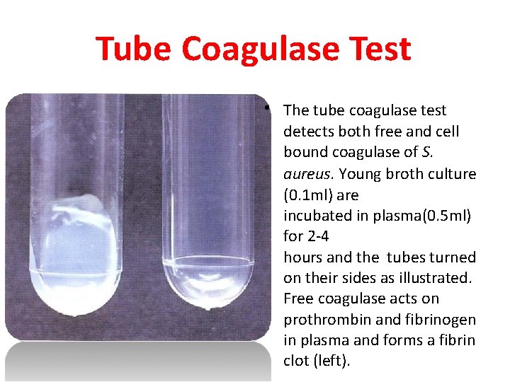 Tube Coagulase Test • The tube coagulase test detects both free and cell bound