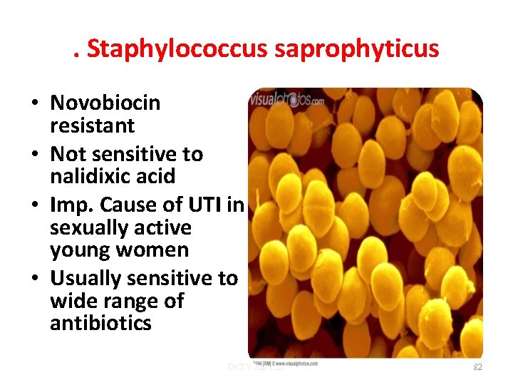 . Staphylococcus saprophyticus • Novobiocin resistant • Not sensitive to nalidixic acid • Imp.