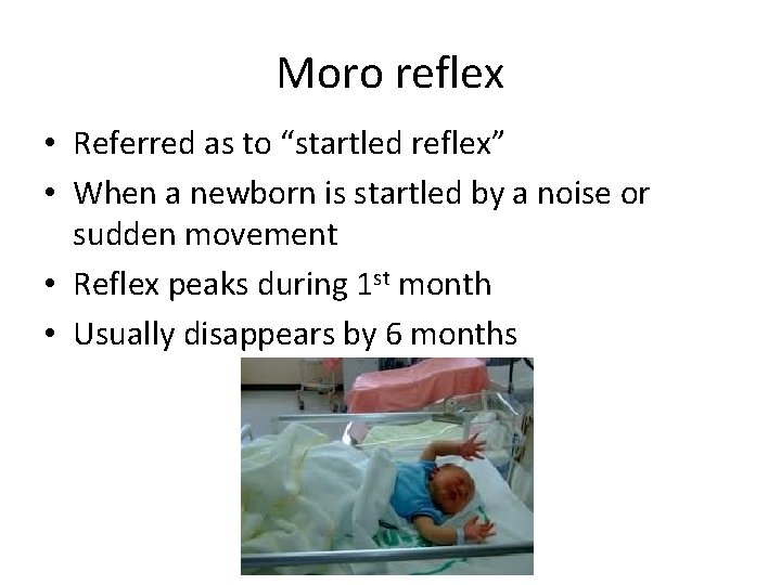 Moro reflex • Referred as to “startled reflex” • When a newborn is startled