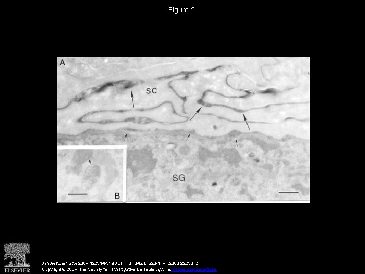 Figure 2 J Invest Dermatol 2004 122314 -319 DOI: (10. 1046/j. 1523 -1747. 2003.