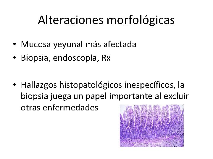 Alteraciones morfológicas • Mucosa yeyunal más afectada • Biopsia, endoscopía, Rx • Hallazgos histopatológicos