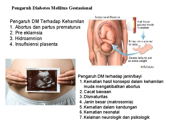 Pengaruh Diabetes Meliitus Gestasional Pengaruh DM Terhadap Kehamilan 1. Abortus dan partus prematurus 2.