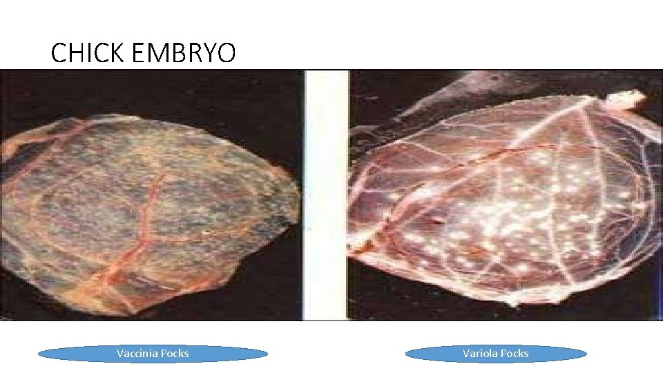 CHICK EMBRYO Vaccinia Pocks Variola Pocks 