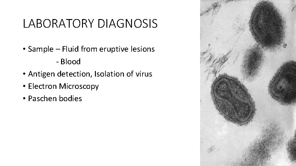 LABORATORY DIAGNOSIS • Sample – Fluid from eruptive lesions - Blood • Antigen detection,