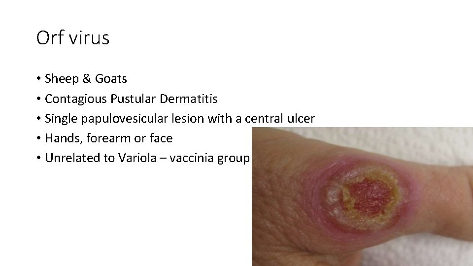 Orf virus • Sheep & Goats • Contagious Pustular Dermatitis • Single papulovesicular lesion