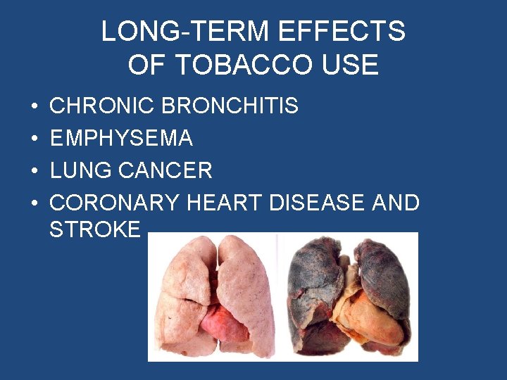 LONG-TERM EFFECTS OF TOBACCO USE • • CHRONIC BRONCHITIS EMPHYSEMA LUNG CANCER CORONARY HEART