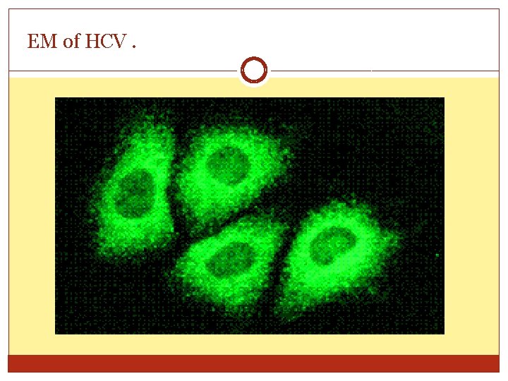 EM of HCV. 
