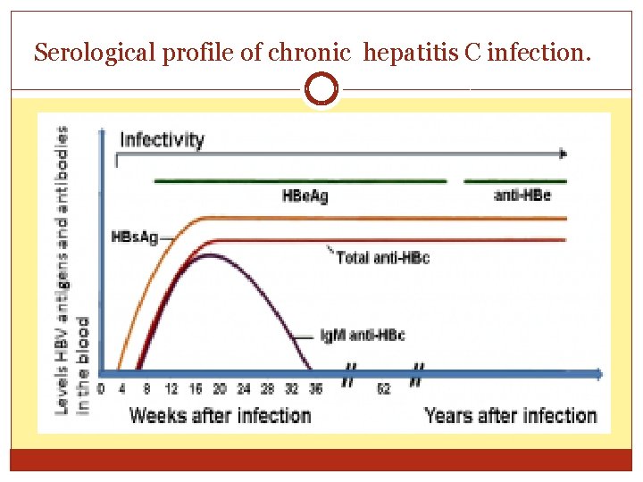 Serological profile of chronic hepatitis C infection. 