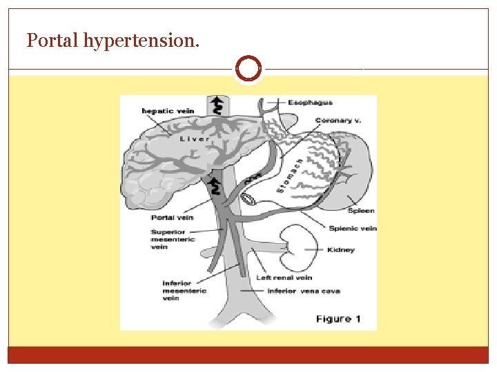 Portal hypertension. 