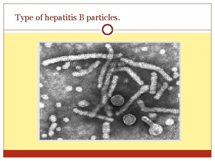 Type of hepatitis B particles. 