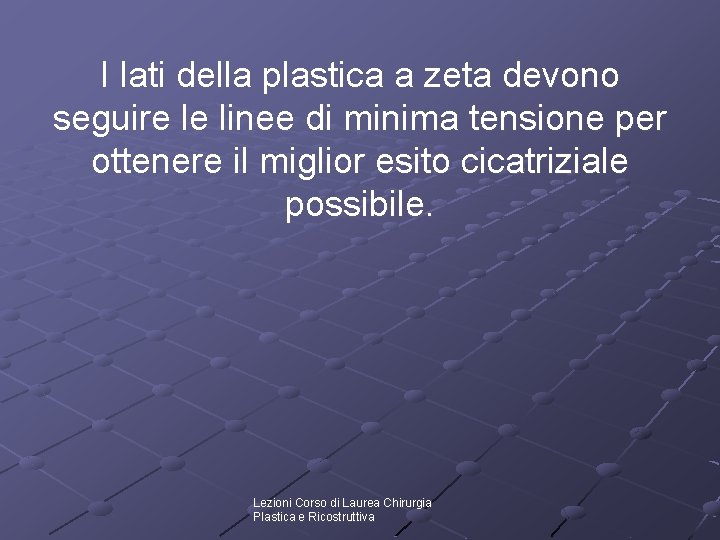 I lati della plastica a zeta devono seguire le linee di minima tensione per