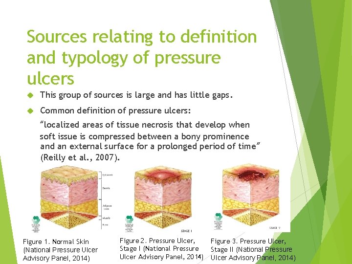 Sources relating to definition and typology of pressure ulcers This group of sources is