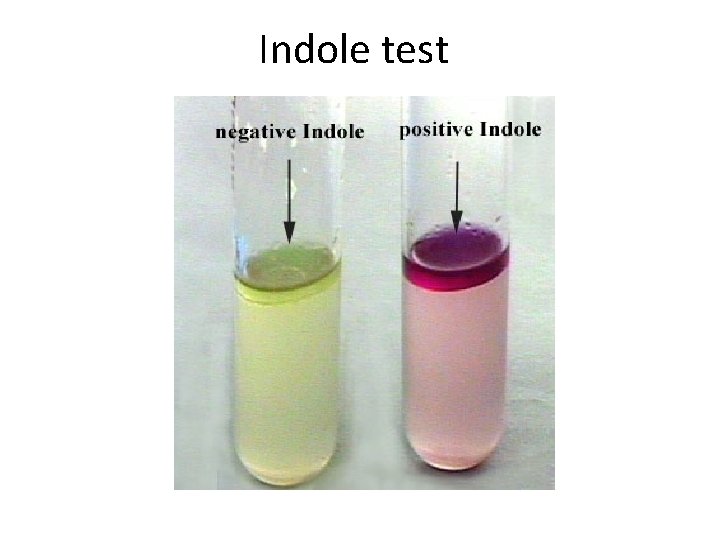 Indole test 
