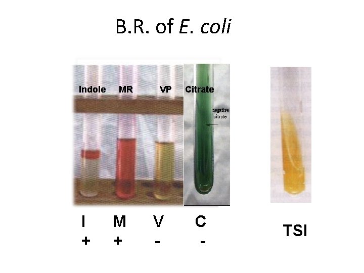 B. R. of E. coli Indole I + MR M + VP V -
