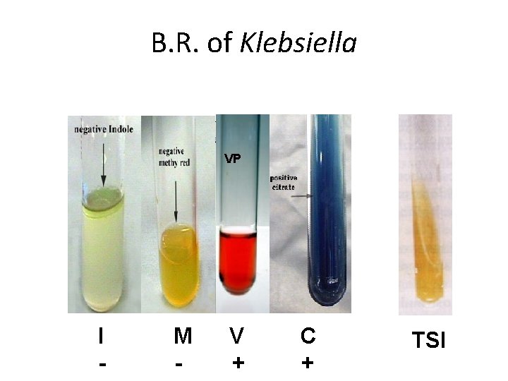 B. R. of Klebsiella VP I - M - V + C + TSI