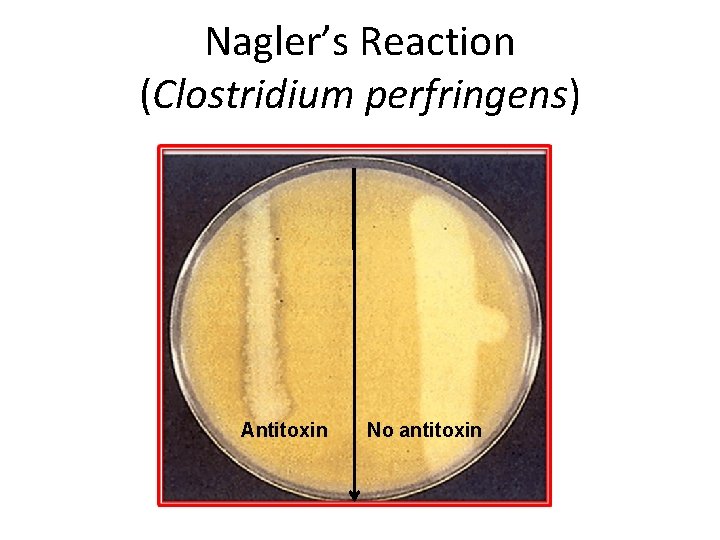 Nagler’s Reaction (Clostridium perfringens) Antitoxin No antitoxin 