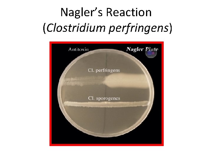 Nagler’s Reaction (Clostridium perfringens) 