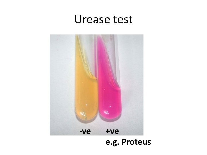 Urease test -ve +ve e. g. Proteus 