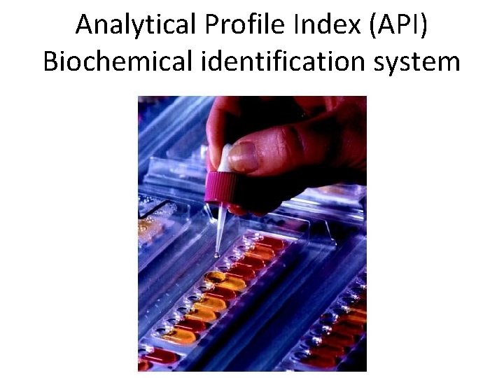 Analytical Profile Index (API) Biochemical identification system 
