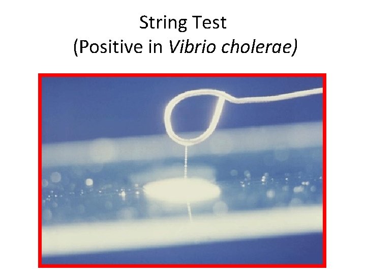 String Test (Positive in Vibrio cholerae) 