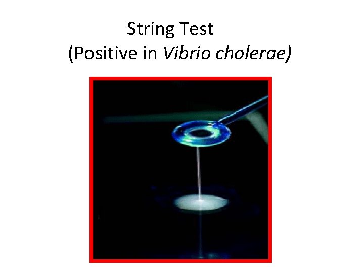 String Test (Positive in Vibrio cholerae) 