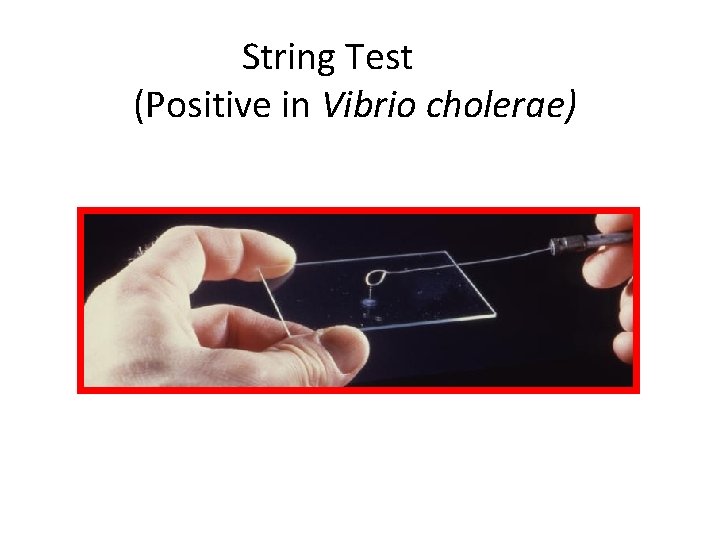 String Test (Positive in Vibrio cholerae) 