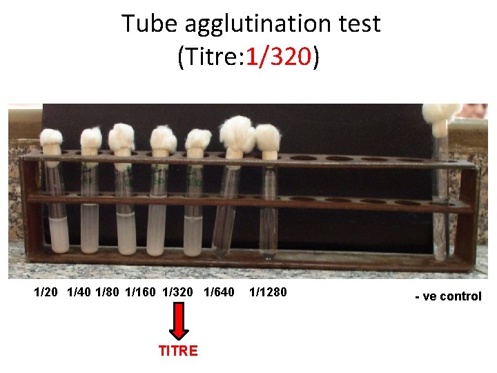 Tube agglutination test (Titre: 1/320) 1/20 1/40 1/80 1/160 1/320 1/640 TITRE 1/1280 -