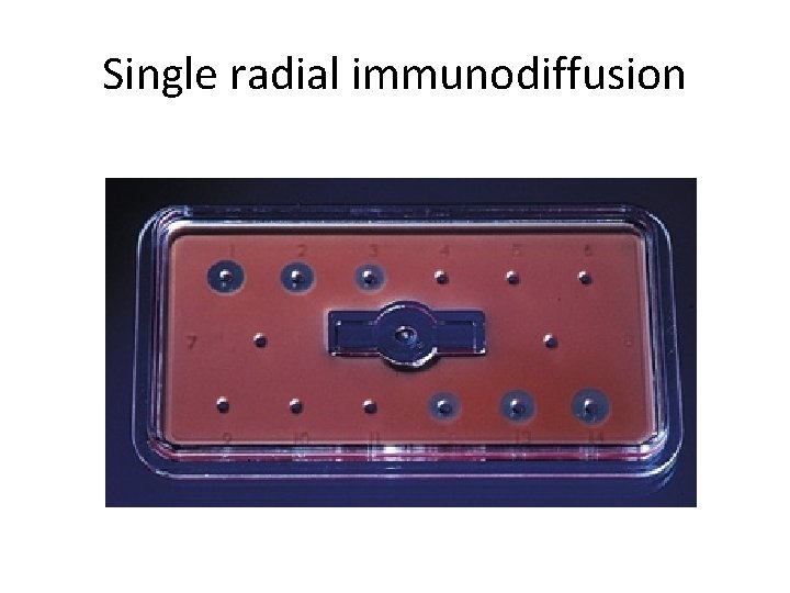 Single radial immunodiffusion 