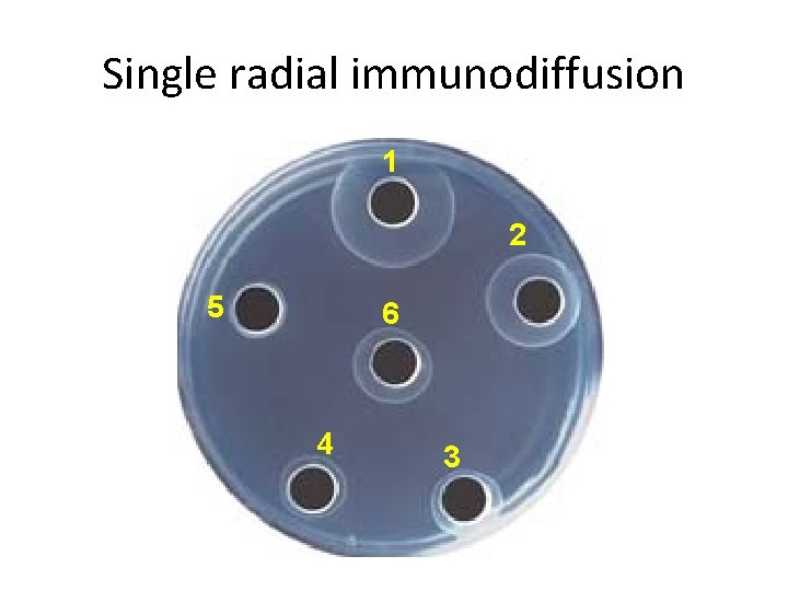 Single radial immunodiffusion 1 2 5 6 4 3 