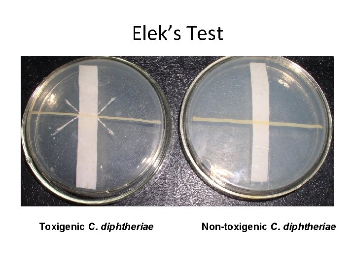 Elek’s Test Toxigenic C. diphtheriae Non-toxigenic C. diphtheriae 