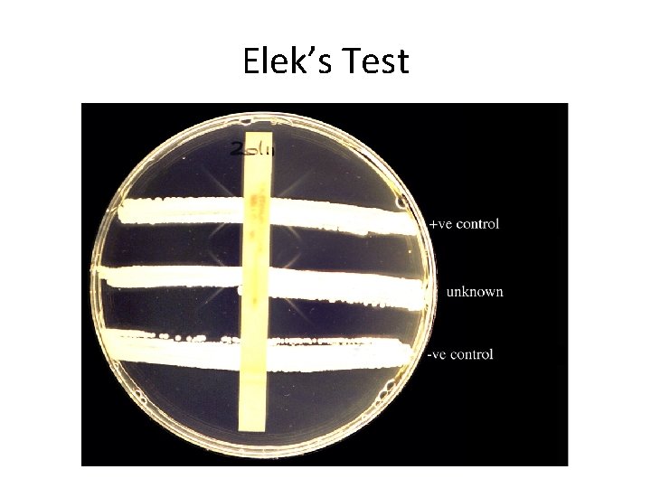 Elek’s Test 